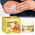 Psoriasis Cream